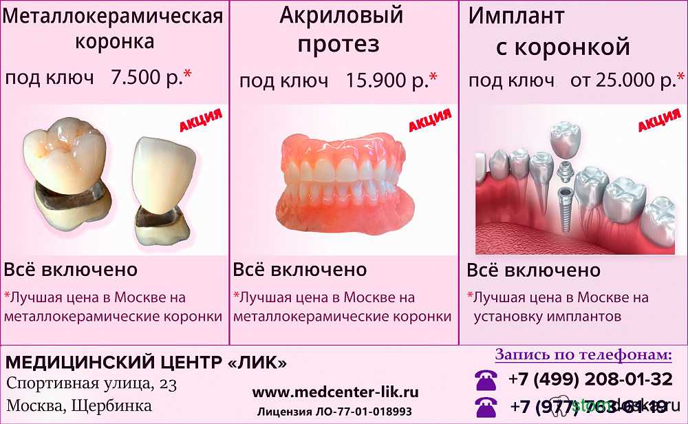 Особенности сверления керамогранита и твёрдой плитки с помощью алмазных коронок