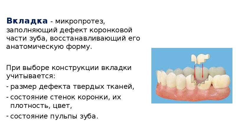 Как и чем сверлить керамогранит